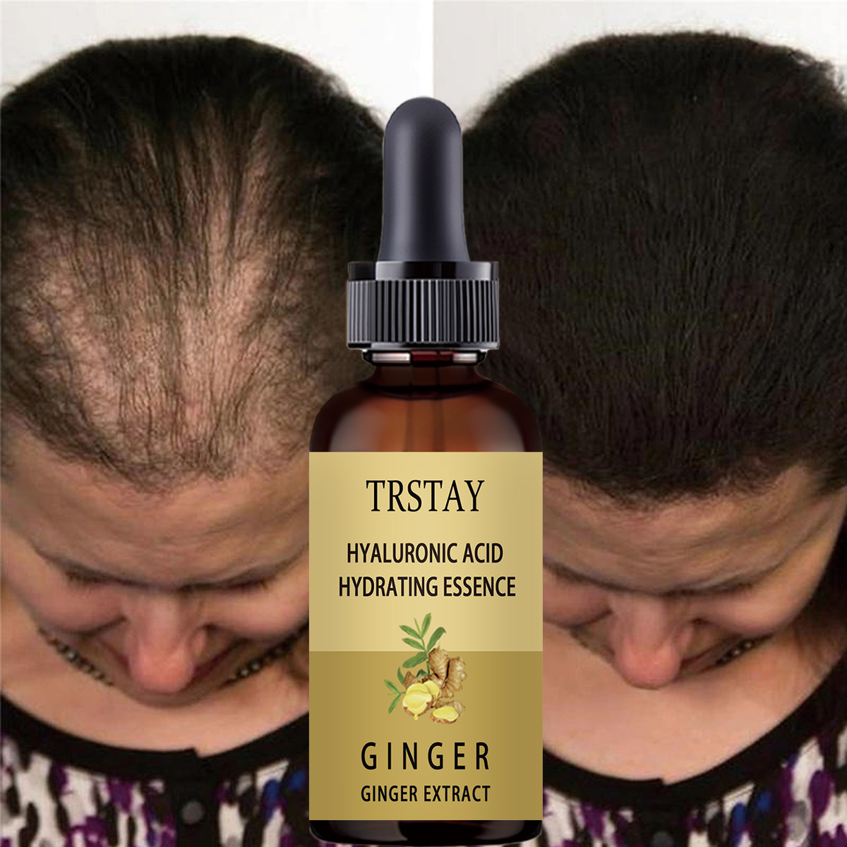 Hair Growth Serum Anti Prevent - Caffeine Hair Serum review and price