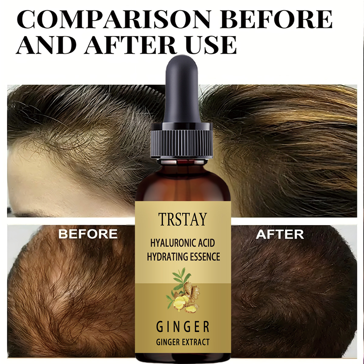Hair Growth Serum Anti Prevent - Caffeine Hair Serum review and price