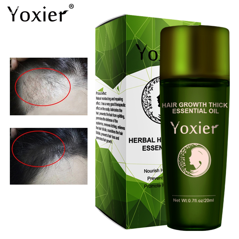 Yoxier Herbal Hair Growth Esse - Hair Care Herbal Products review and price
