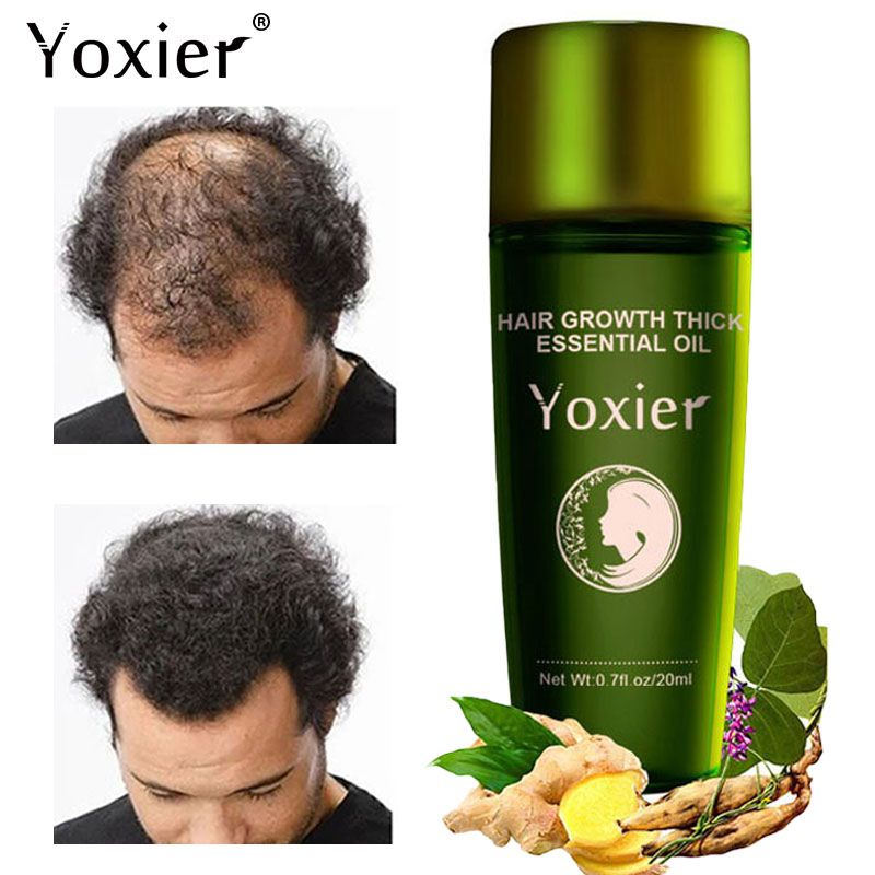 Yoxier Herbal Hair Growth Esse - Hair Care Herbal Products review and price