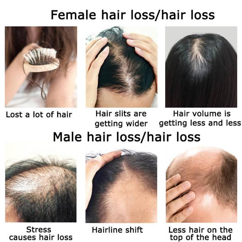 Ginger Hair Growth Essential O - Hair Care Herbal Products review and price