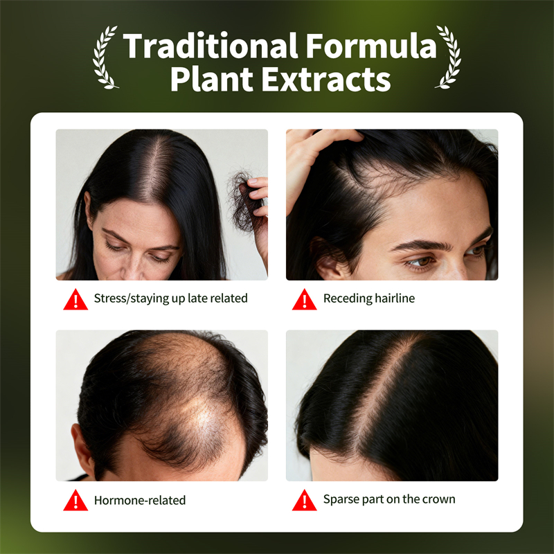 Natural Hair Growth Set Usman  - Hair Care Herbal Products review and price