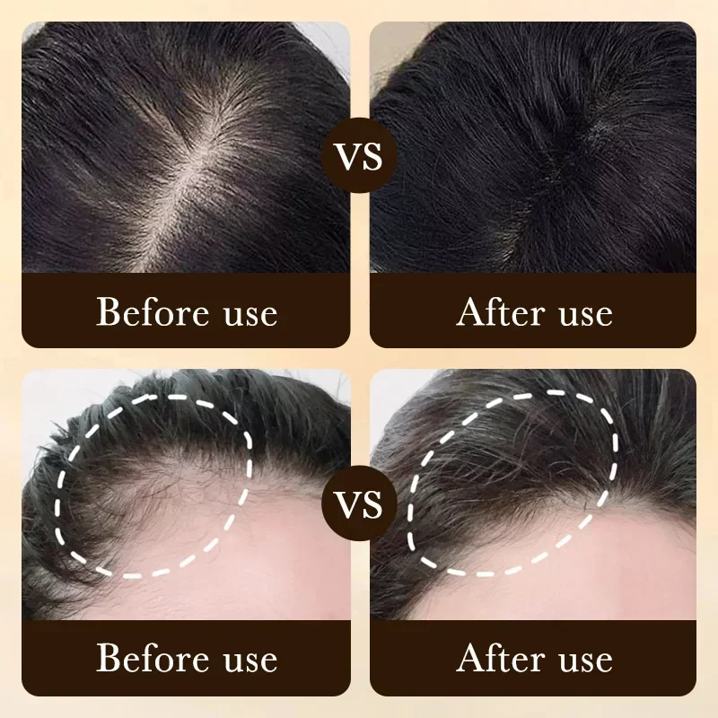 Biotin Fast Hair Growth Oil Pr - Caffeine Hair Serum review and price