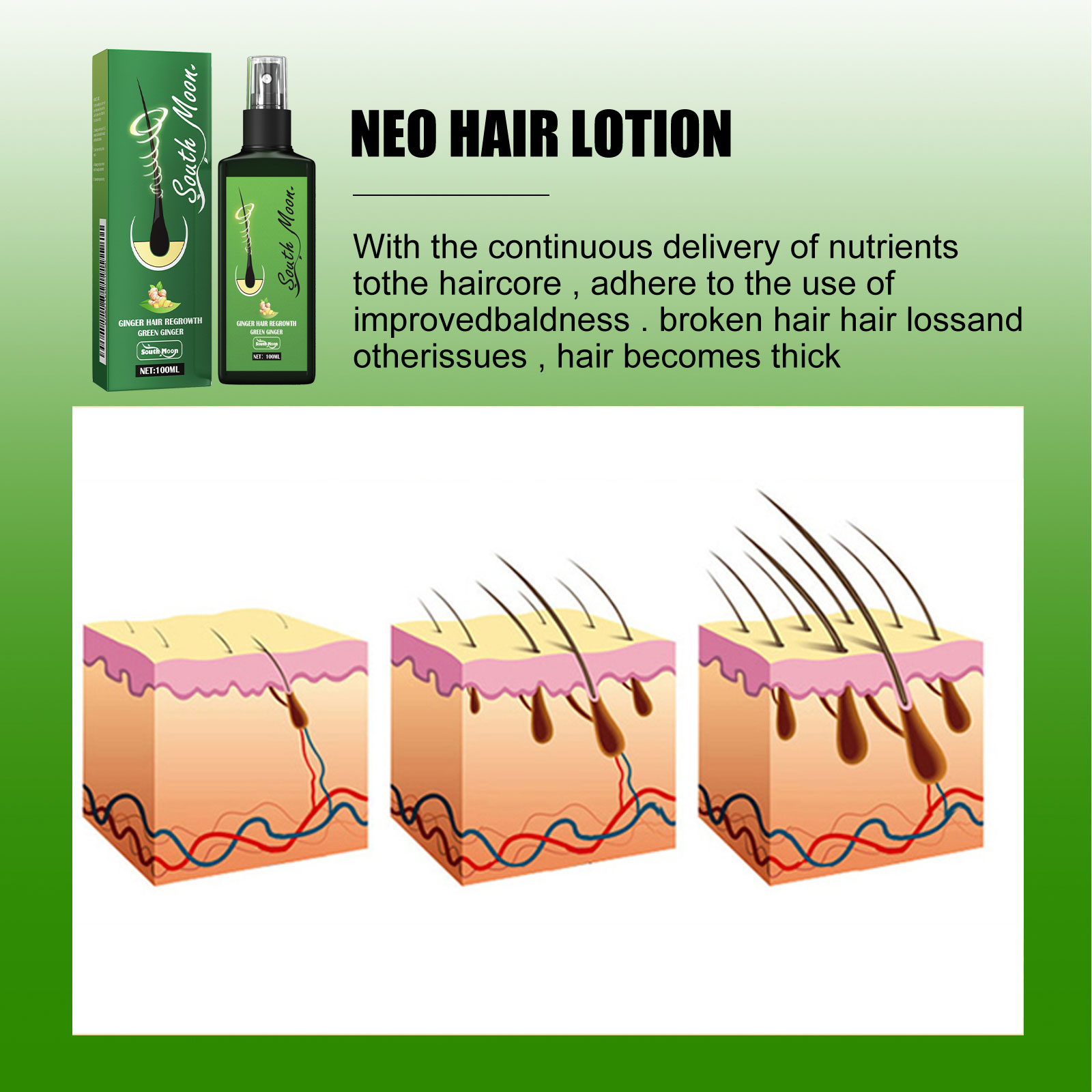 Ginger Hair Care Spray Promote - Hair Care Herbal Products review and price