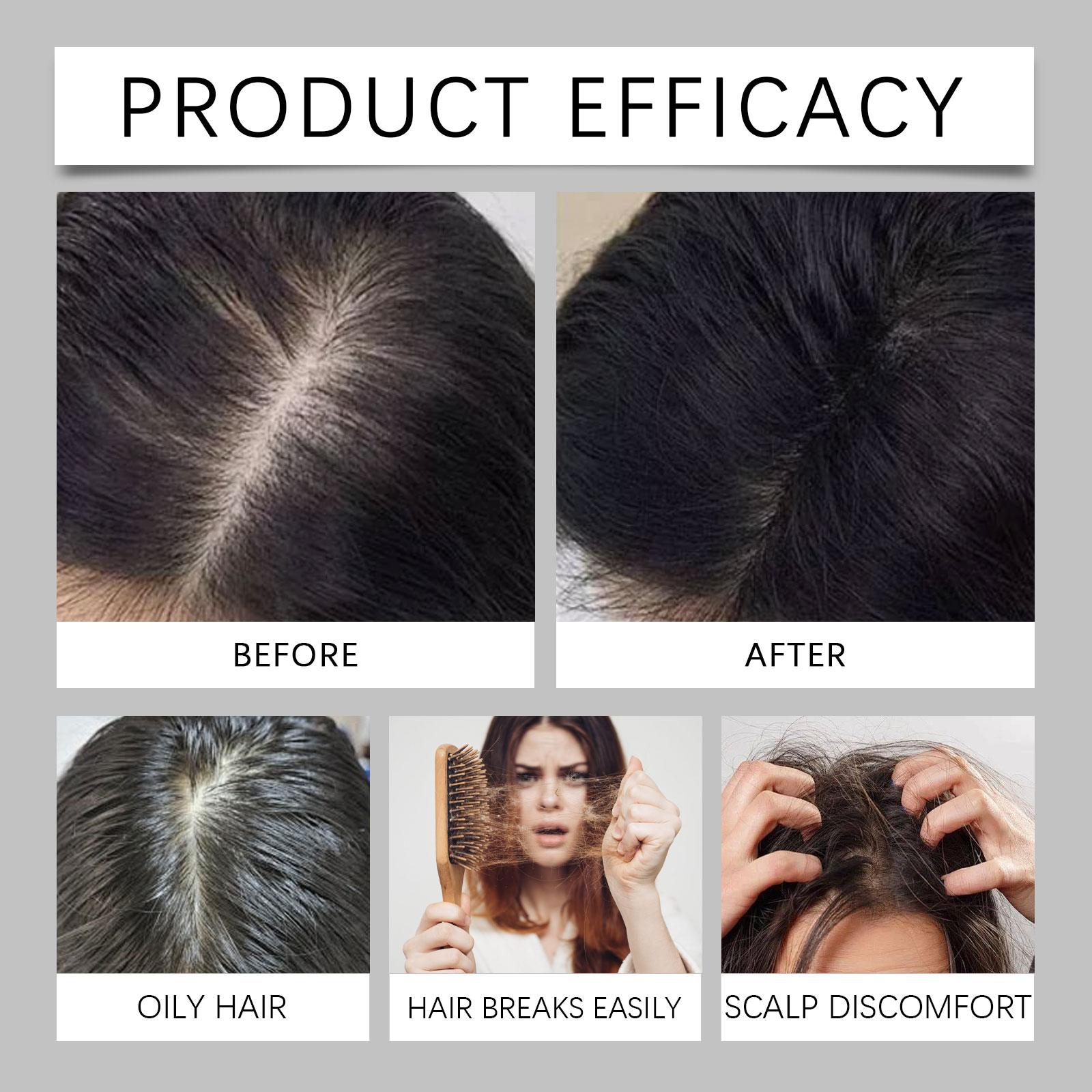 Polygonum Multiflorum Hair Car - Caffeine Hair Serum review and price