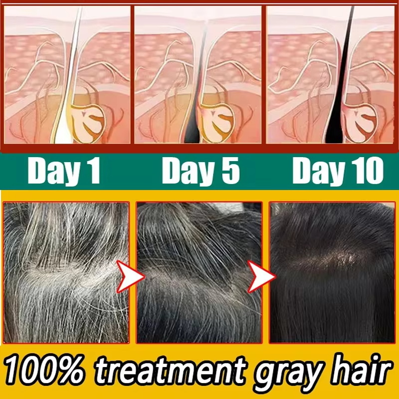 Herbal Anti-grey Hair Treatmen - Hair Care Herbal Products review and price