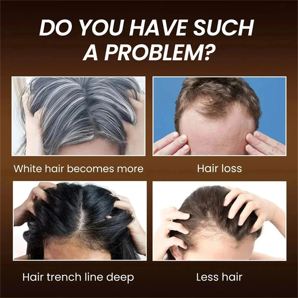 Herbal Anti-grey Hair Treatmen - Hair Care Herbal Products review and price