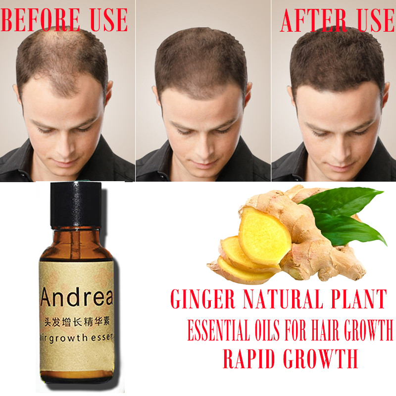 2/5/10Pcs Andrea Hair Growth S - Hair Care Herbal Products review and price