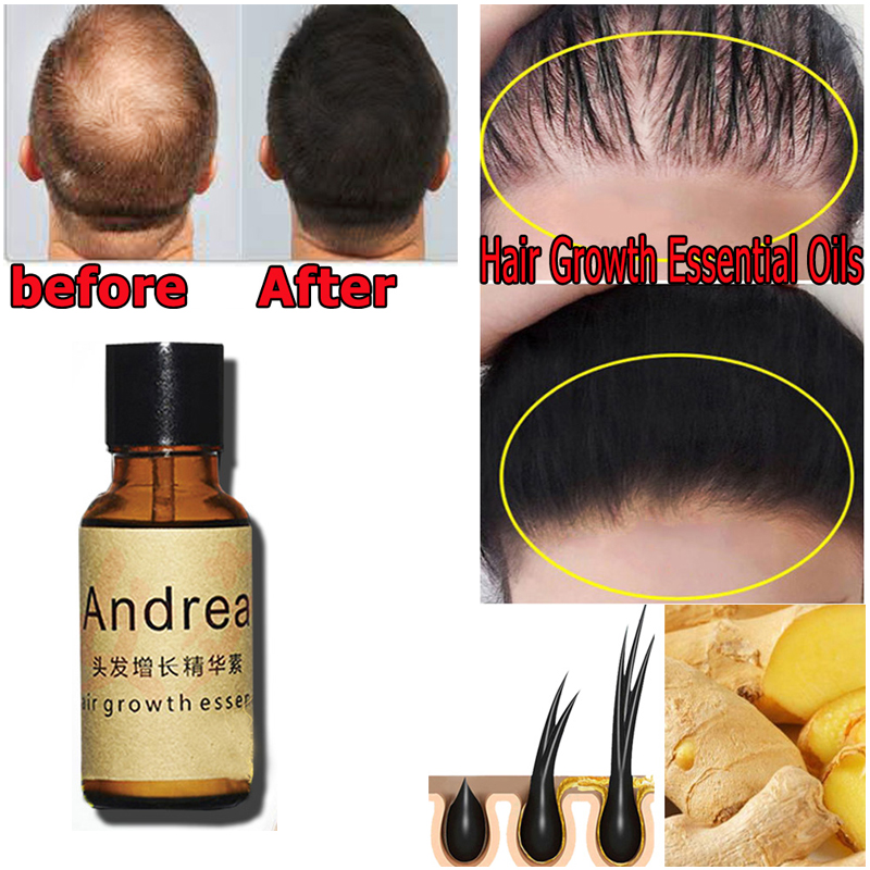 2/5/10Pcs Andrea Hair Growth S - Hair Care Herbal Products review and price
